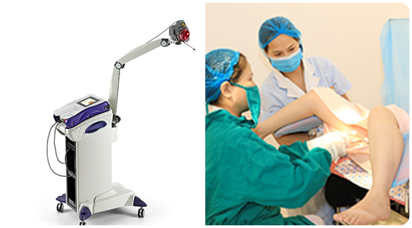 may-dieu-tri-laser-cong-suat-thap