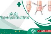 Có nến cắt bao quy đầu không? Những ai cần cắt bao quy đầu