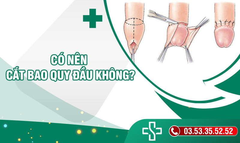 Có nến cắt bao quy đầu không? Những ai cần cắt bao quy đầu